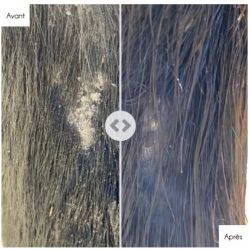 Shampoing dermite cheval Shampoo Tea Tree Animaderm 500ml - Le Paturon