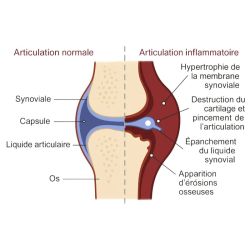 Ultra Joint Flex Vital Herbs - Articulation cheval - Le Paturon
